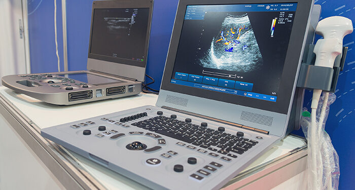 Portable Ultrasound Machine